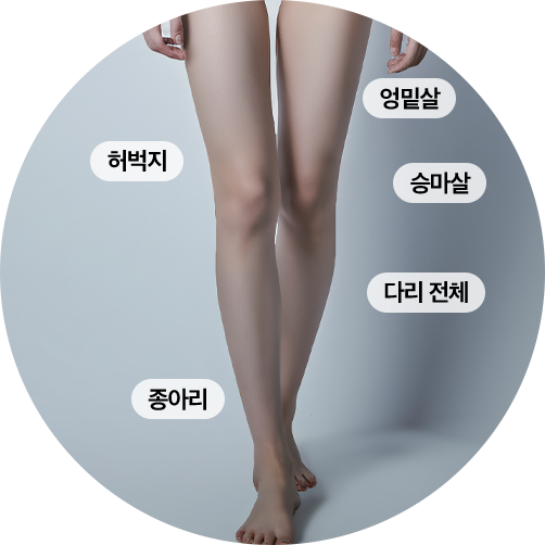 하체 비만 이미지