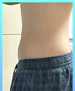 after 사진