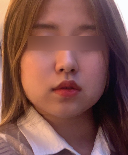 before 사진
