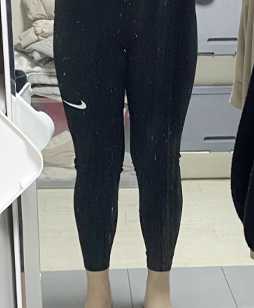 before 사진