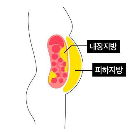 복부 지방 일러스트